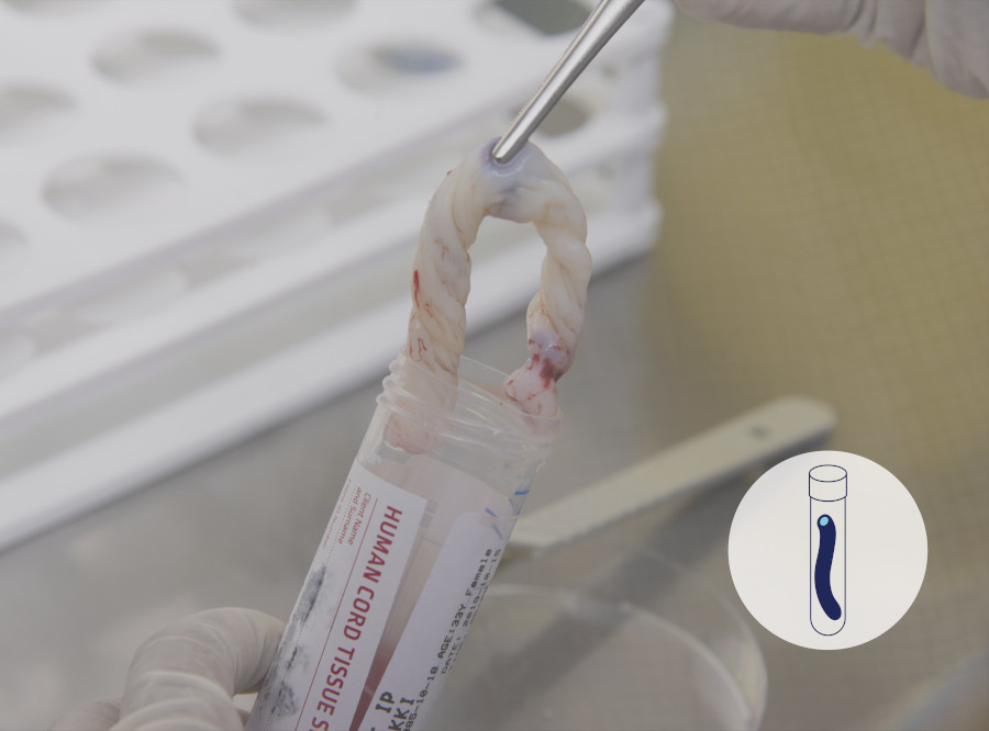 HCP-Netcells- cord tissue img