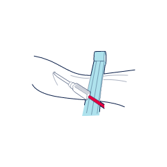 Nextcells - HCP - Collection Kit - 4