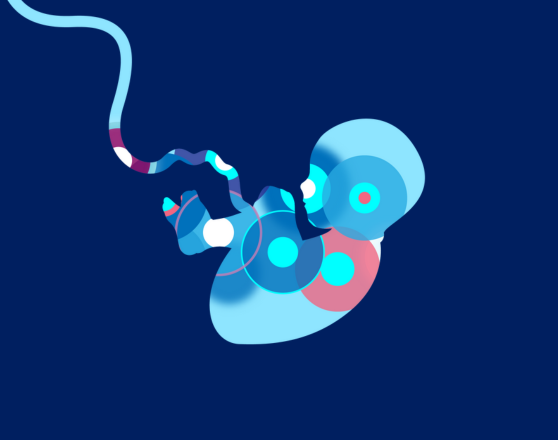 'Get out of jail free card'